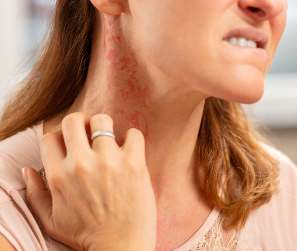 allergy-in-adyar,perungudi,thuraipakkam,thoraipakkam allergy-in-adyar,perungudi,thuraipakkam,thoraipakkam